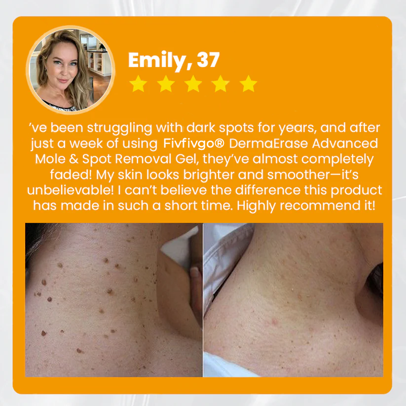 Fivfivgo® DermaErase Advanced Mole & Spot Removal Gel