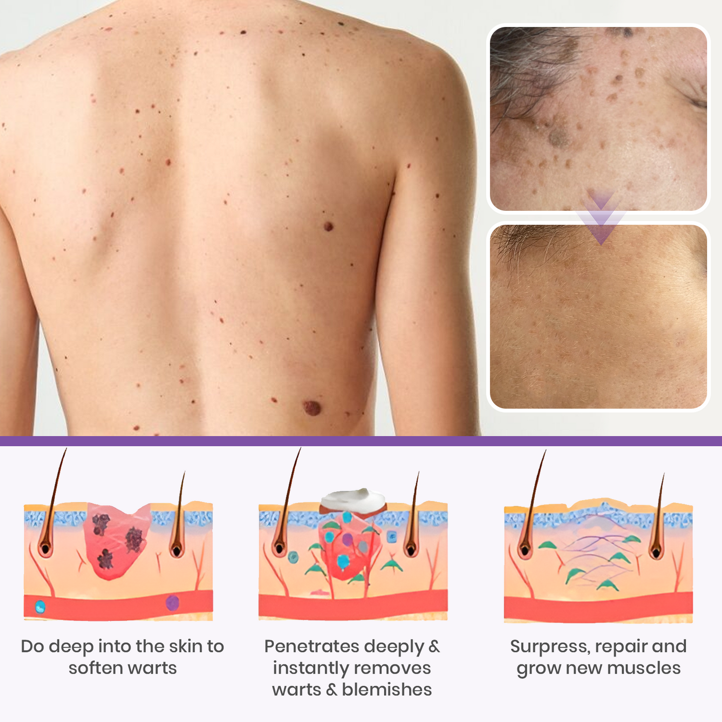 Fivfivgo® Clarivine Dissolver Mole & Dark Spot Removal Bio-Gel