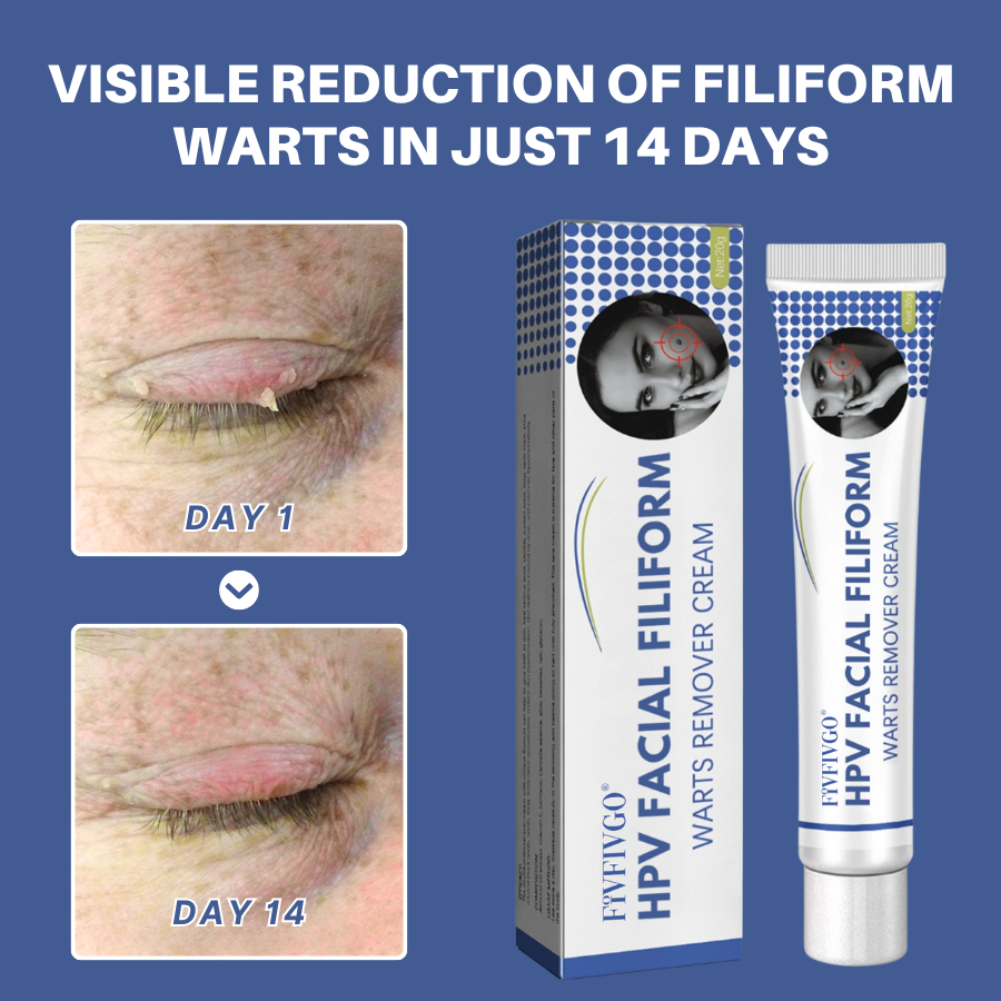 Fivfivgo® HPV Facial Filiform Warts Removal Cream PRO
