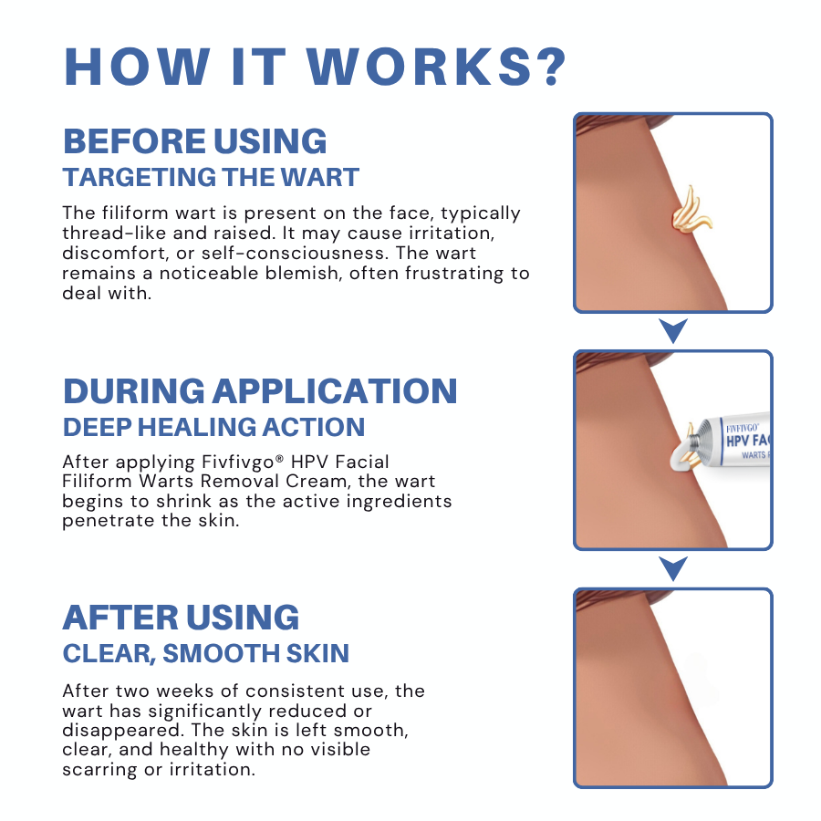 Fivfivgo® HPV Facial Filiform Warts Removal Cream PRO