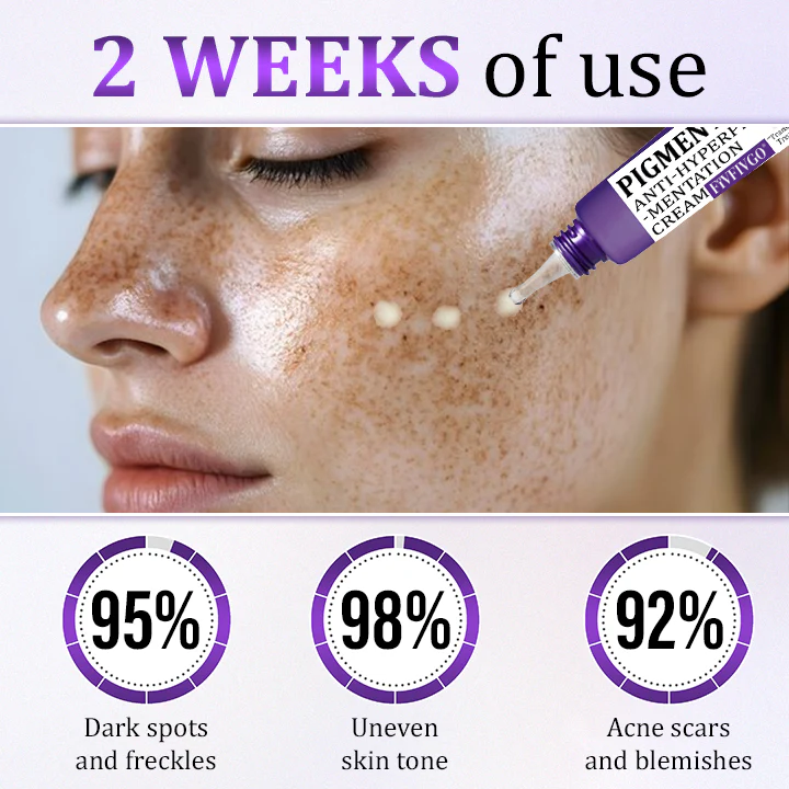 Fivfivgo® PigmentaX ProFade Anti-Hyperpigmentation Cream