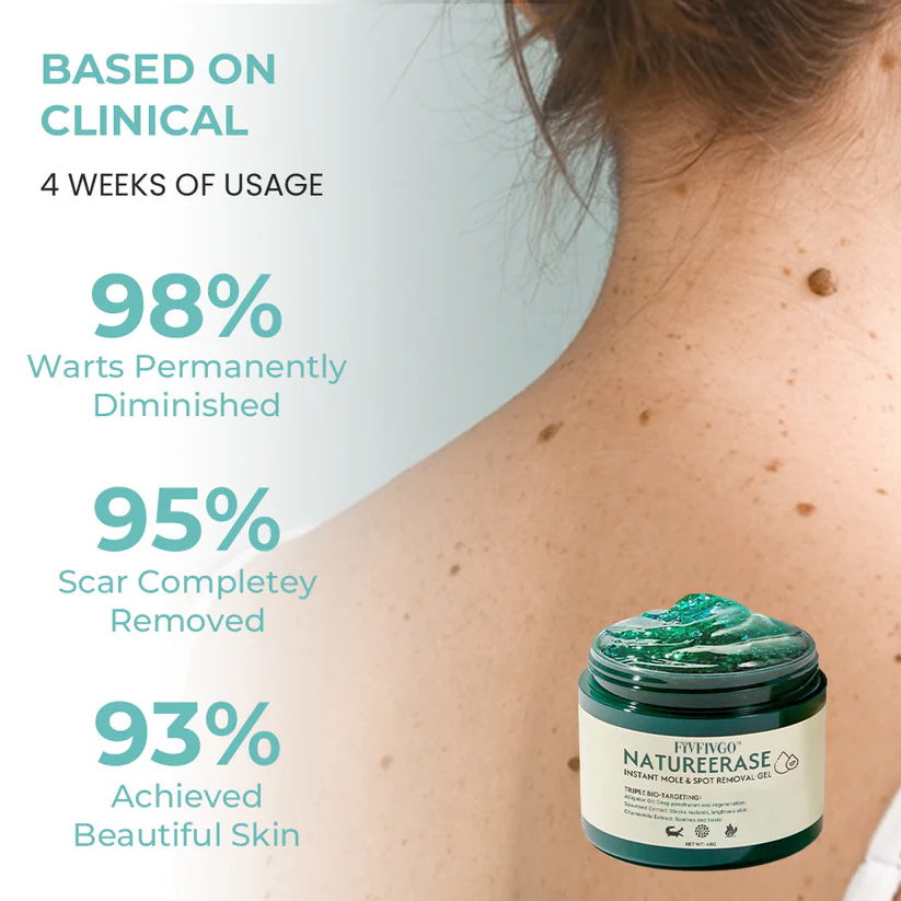 ✅ Official Store: Fivfivgo™ NatureErase Instant Mole & Spot Removal Gel