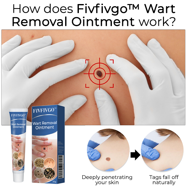 Fivfivgo™ Wart Removal Ointment