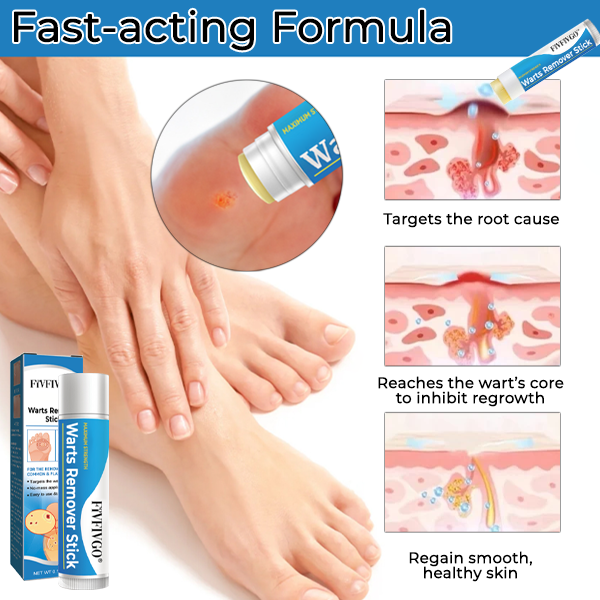 Fivfivgo® Warts Remover Stick