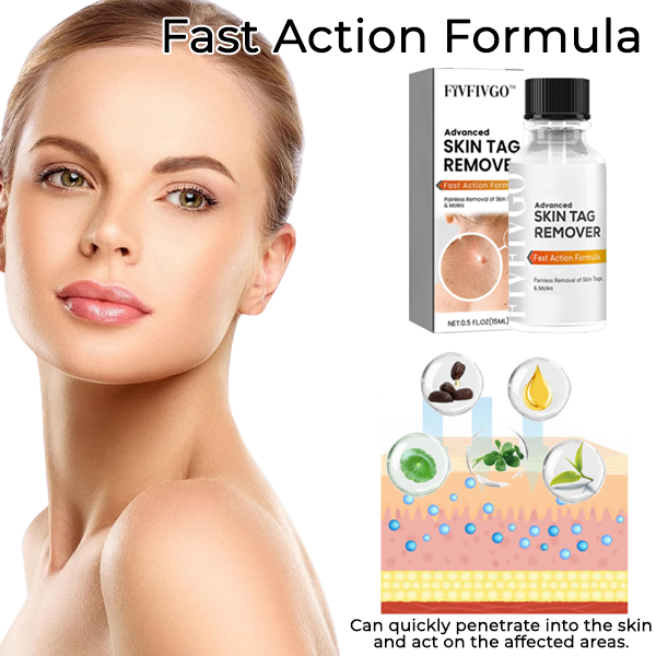 Fivfivgo™ Advanced Skin Tag Remover - Fast Action Formula
