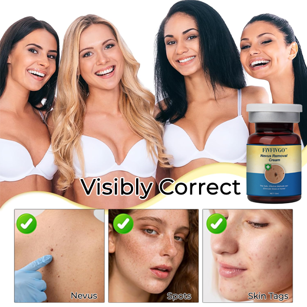 Fivfivgo™ Nevus Removal Cream