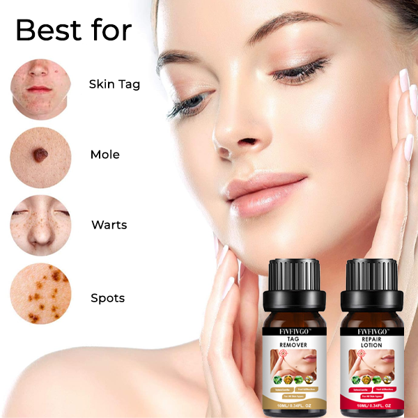 Fivfivgo™ Skin Tag Removal & Repair Kit