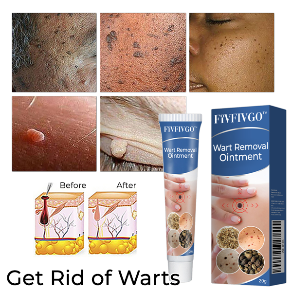 Fivfivgo™ Wart Removal Ointment