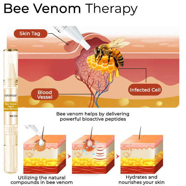Fivfivgo™ Bee Venom Tags & Moles Remover