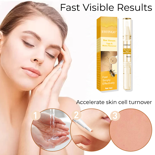 Fivfivgo™ Bee Venom Tags & Moles Remover