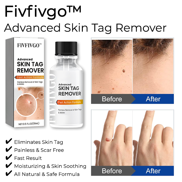 Fivfivgo™ Advanced Skin Tag Remover - Fast Action Formula