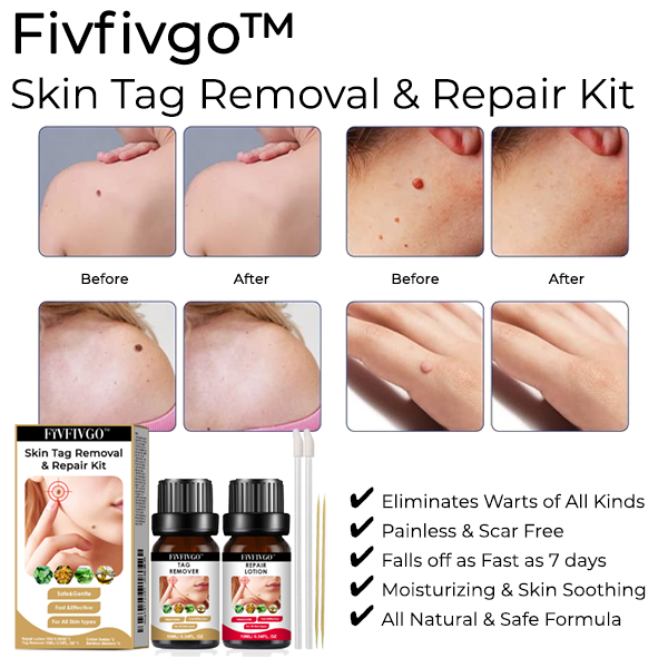 Fivfivgo™ Skin Tag Removal & Repair Kit