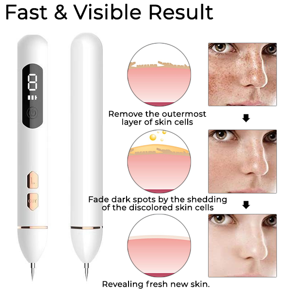 Fivfivgo™ Laser Spot Removal Pen