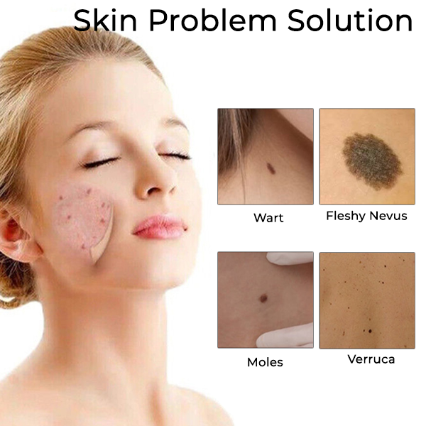 Fivfivgo™ Laser Spot Removal Pen
