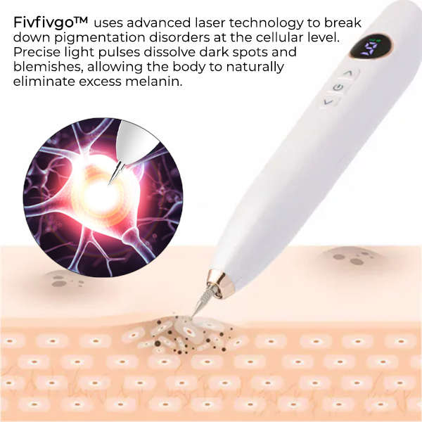 Fivfivgo™ Laser Spot Removal Pen