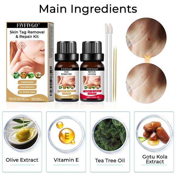 Fivfivgo™ Skin Tag Removal & Repair Kit