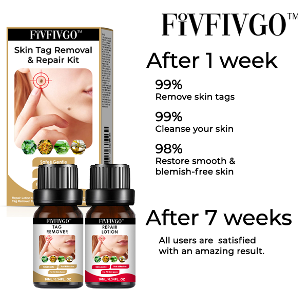 Fivfivgo™ Skin Tag Removal & Repair Kit