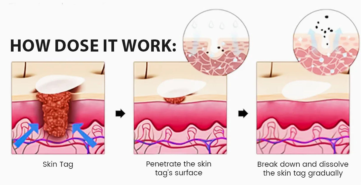 Fivfivgo® MicroZaps Hydrocolloid Tag Patch 18 Fivfivgo® MicroZaps Hydrocolloid Tag Patch