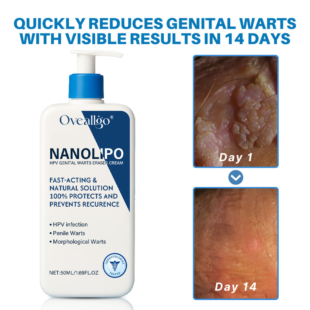 Oveallgo® NanoLipo HPV Genital Warts Eraser Cream 18 Oveallgo® NanoLipo HPV Genital Warts Eraser Cream