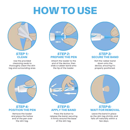 Fivfivgo® Painless At-home Skin Tag Removal Pen