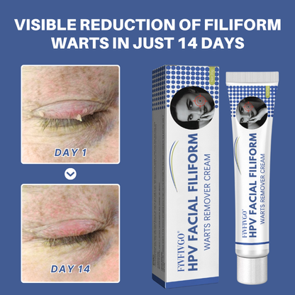 Fivfivgo® HPV Facial Filiform Warts Removal Cream PRO