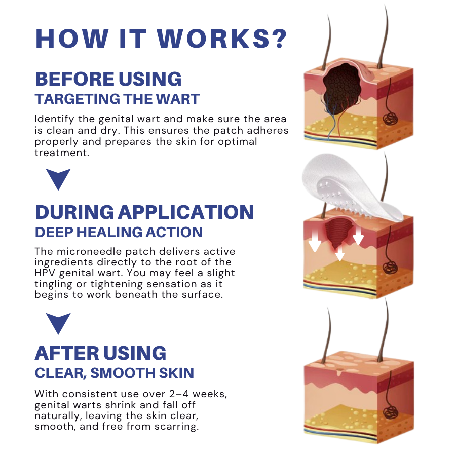 Fivfivgo® Microneedle HPV Genital Warts Removal Patch PRO