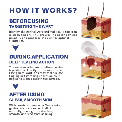 Fivfivgo® Microneedle HPV Genital Warts Removal Patch PRO