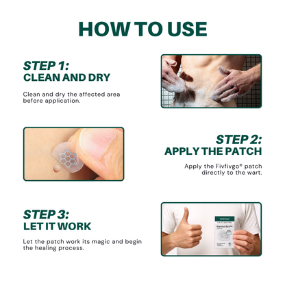 Fivfivgo® Magnesium MicroPin HPV Genital Wart Removal Patch
