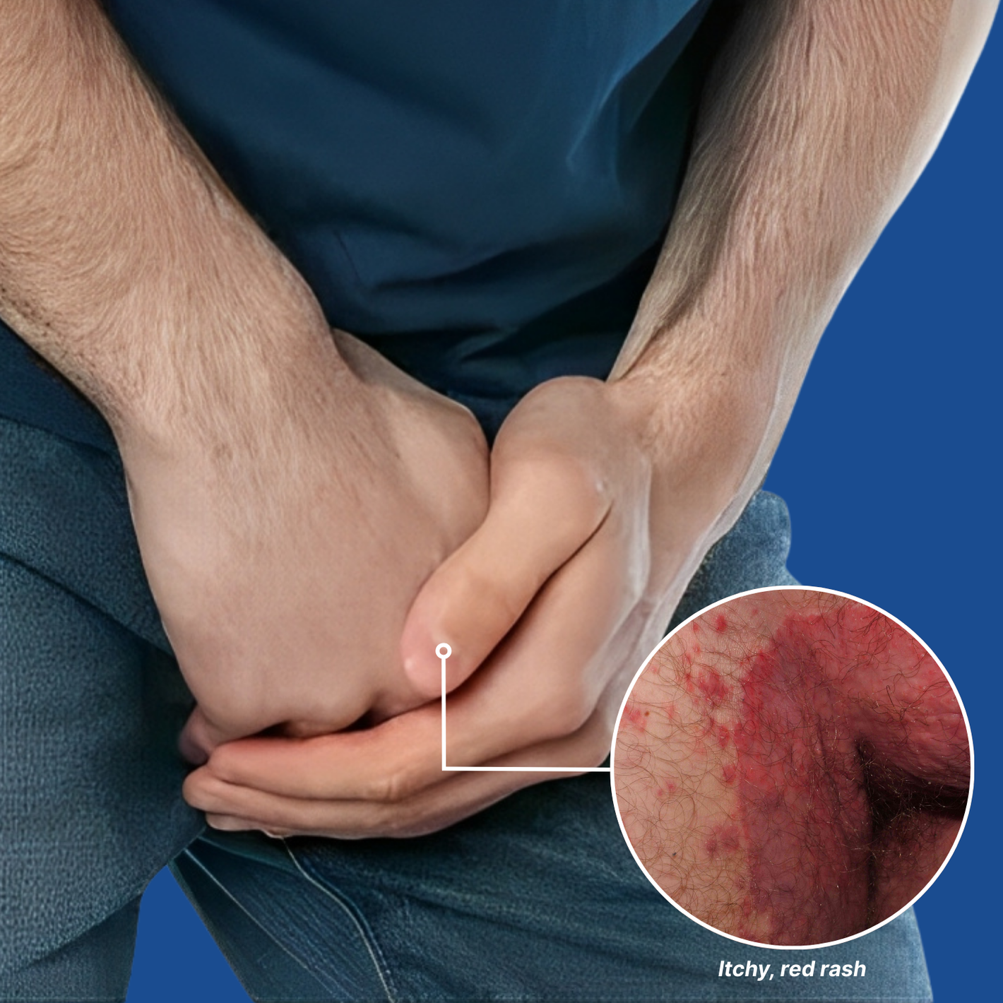 250825 Fivfivgo Scrotum Itchy Treatment Cream Img3