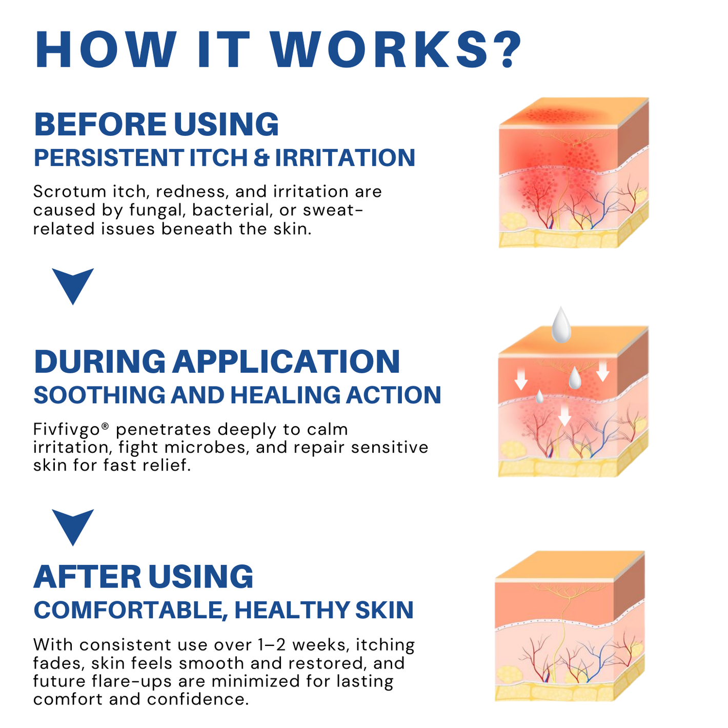 Fivfivgo® Scrotum Itchy Treatment Cream image Fivfivgo® Scrotum Itchy Treatment Cream