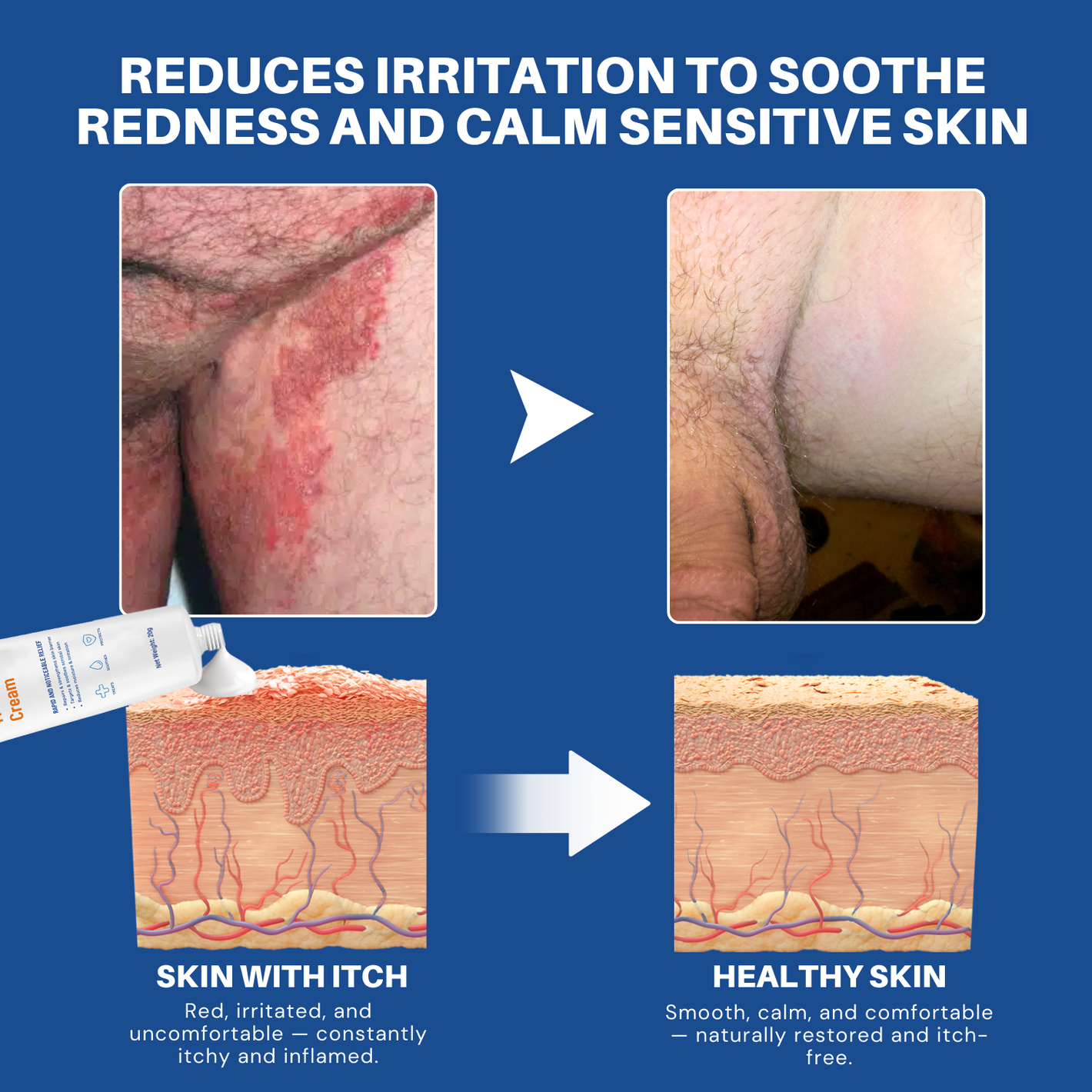 Fivfivgo® Scrotum Itchy Treatment Cream image Fivfivgo® Scrotum Itchy Treatment Cream