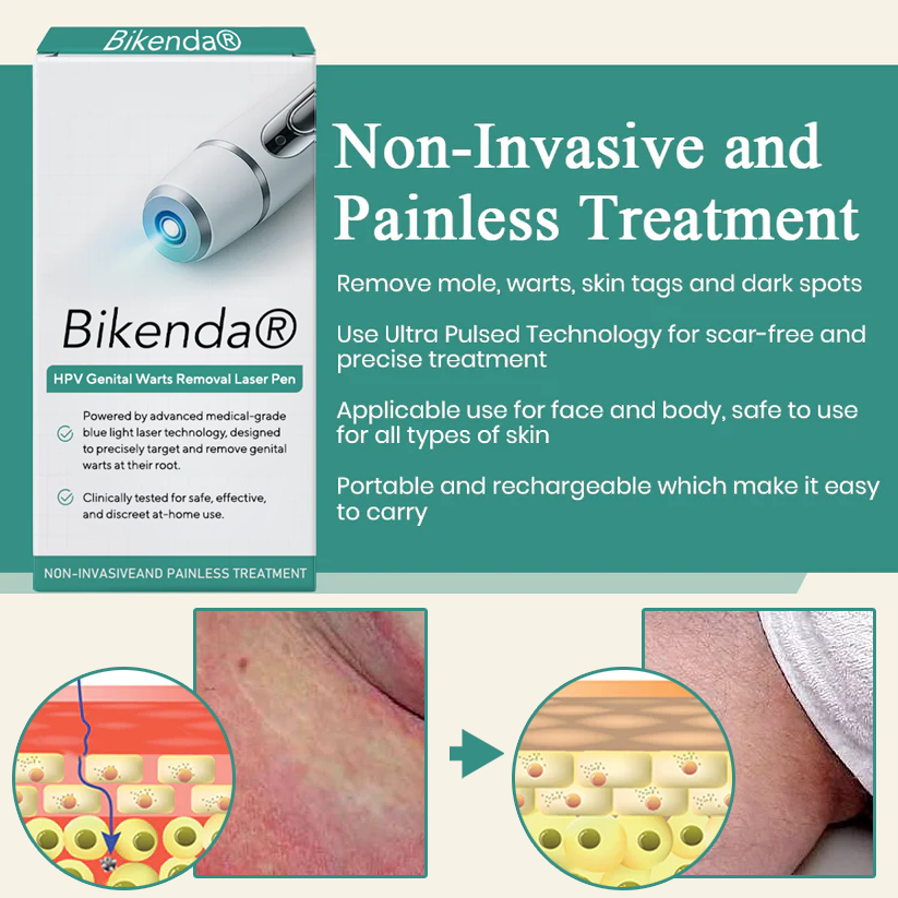 Bikenda® HPV Genital Warts Removal Laser Pen 20 Bikenda® HPV Genital Warts Removal Laser Pen