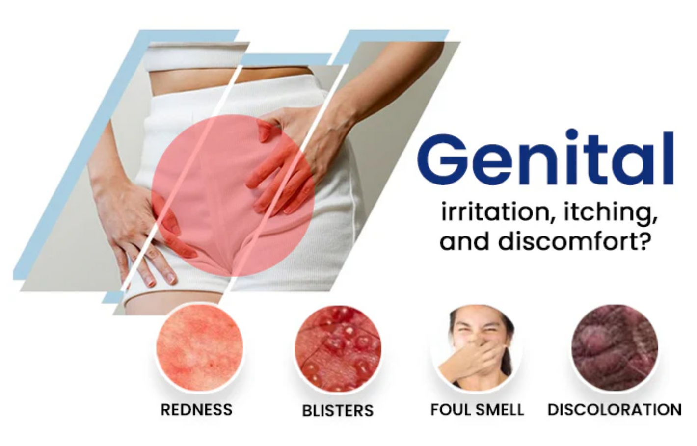 Fivfivgo® Genital Treatment Spray image Fivfivgo® Genital Treatment Spray