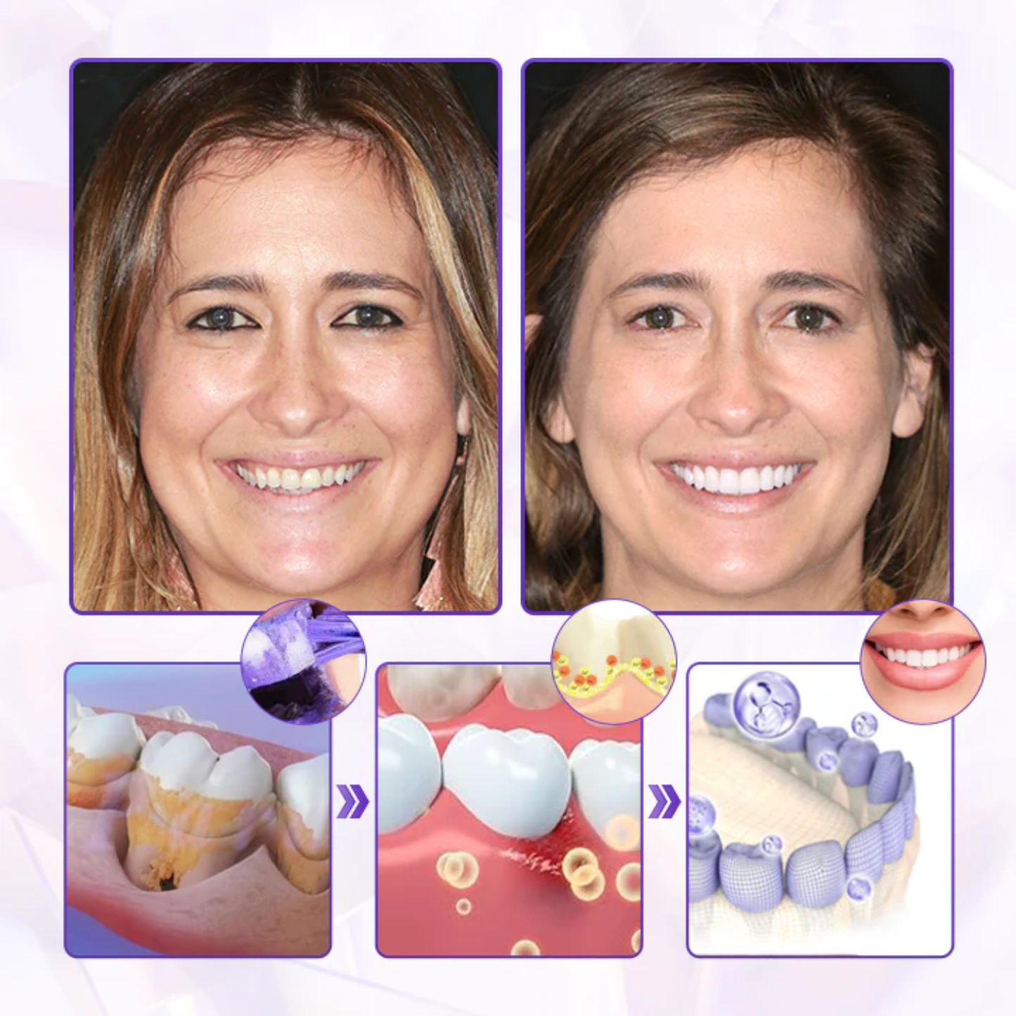 Fivfivgo® BeeRenew Advanced Gum Healing Toothpaste