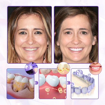 Fivfivgo® BeeRenew Advanced Gum Healing Toothpaste