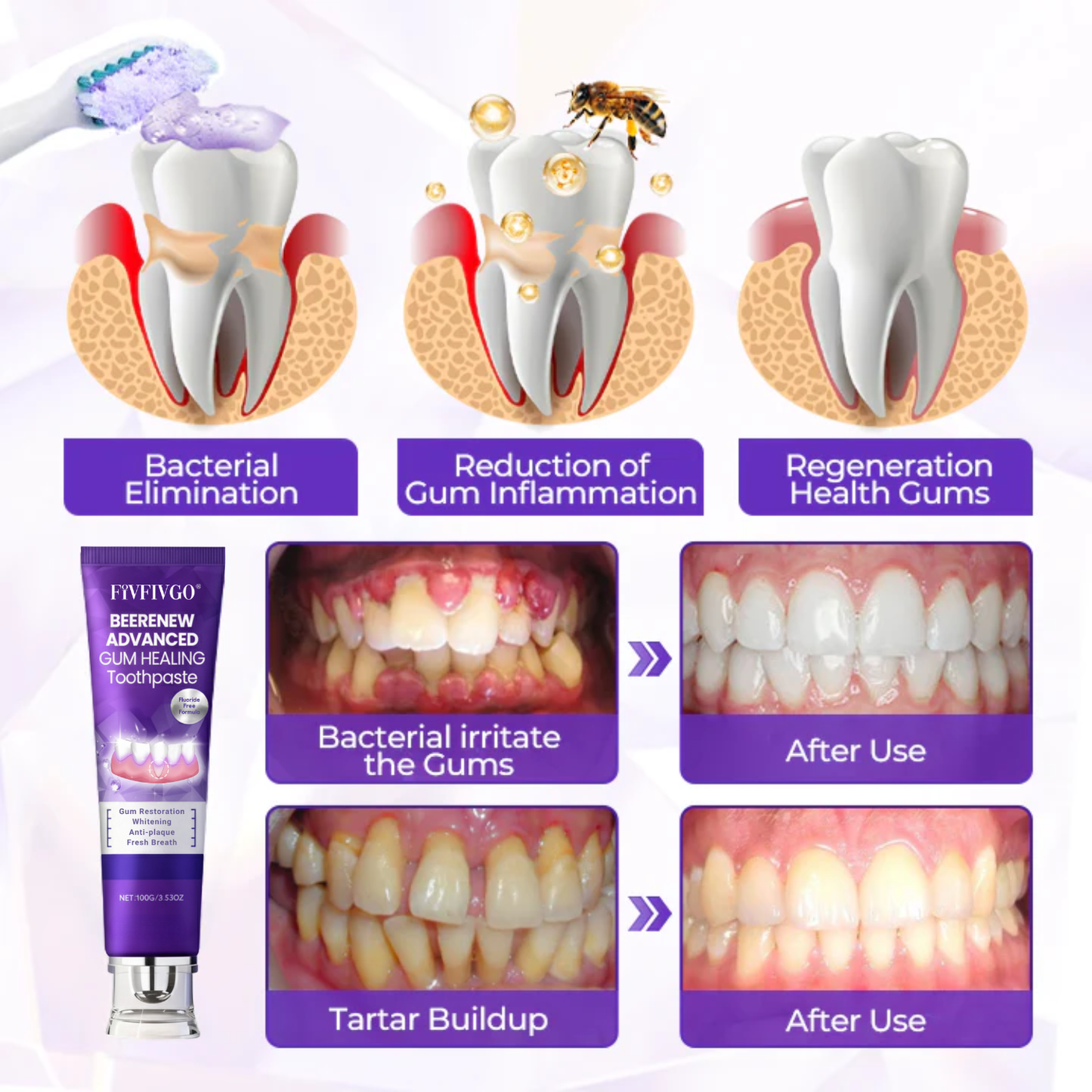 Fivfivgo® BeeRenew Advanced Gum Healing Toothpaste