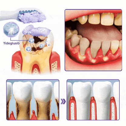 Fivfivgo® BeeRenew Advanced Gum Healing Toothpaste