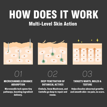 Oveallgo® Korean DermaClear Reedle Shot 100 Wart & Mole Eraser Serum