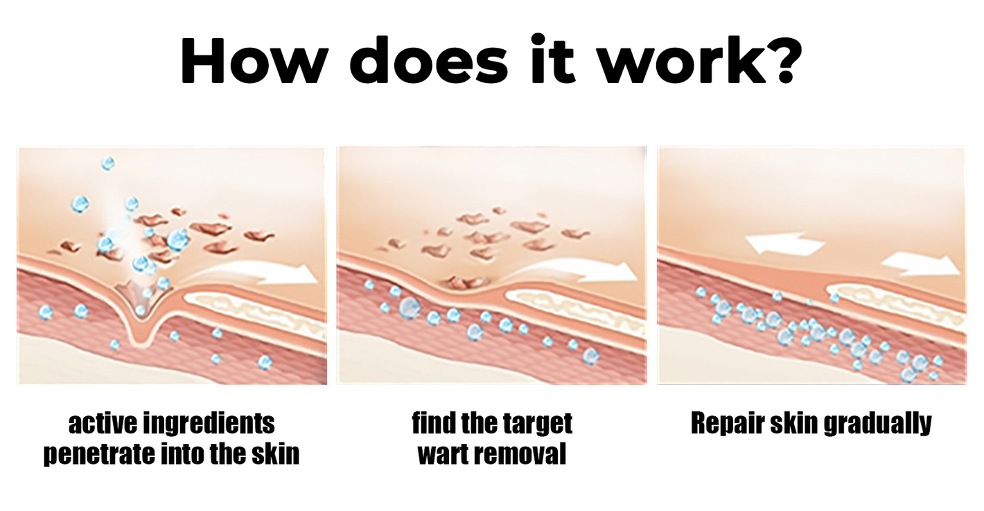 Fivfivgo® Bacteriostatic Black Cumin Skin Tag Remover 21 3 d6902142 d1f7 4992 a639 7c3fac5869ac