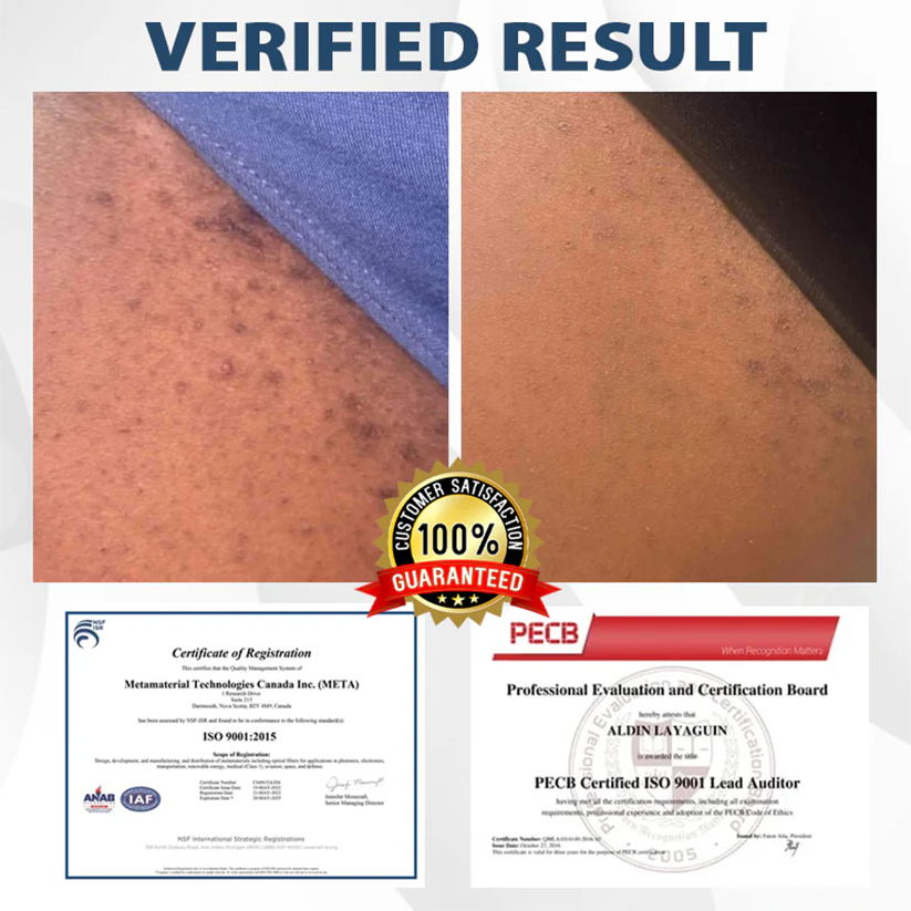 Fivfivgo® ManGuard HPV WART Healing Cream