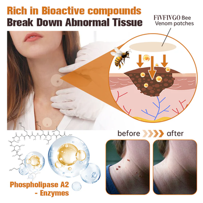Fivfivgo™ WartGone Bee Venom Treatment Patch (150PCS/PACK)