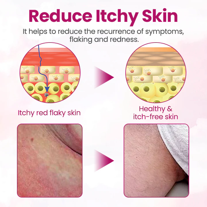 Fivfivgo® Women’s GentY HPV Relief Cream
