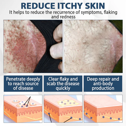 Fivfivgo® ManGuard HPV WART Healing Cream