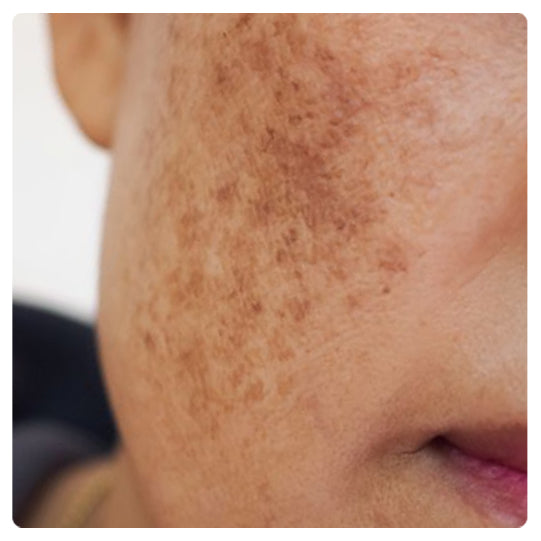 7 1 cf6a9e96 1e40 4a71 b5b7 c18a67383393