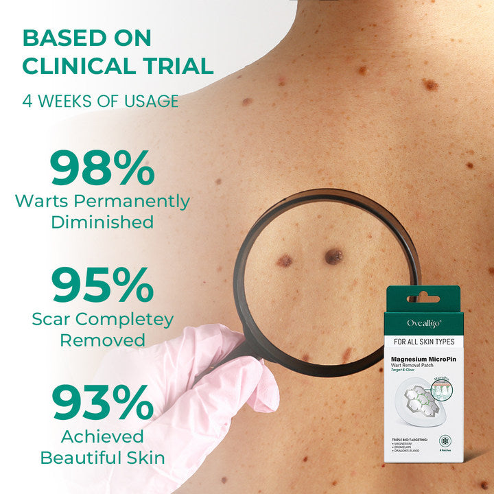 Oveallgo® Magnesium MicroPin Target & Clear Wart Removal Patch 37 Oveallgo® Magnesium MicroPin Target & Clear Wart Removal Patch