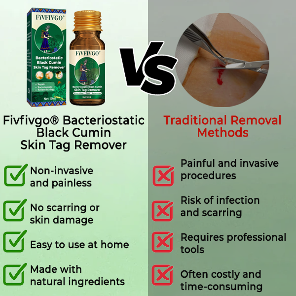 Fivfivgo® Bacteriostatic Black Cumin Skin Tag Remover 27 7 5a0ee0bf e6a4 44b9 9bc8 6241b22d28aa