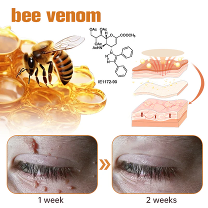 Fivfivgo™ WartGone Bee Venom Treatment Patch (150PCS/PACK)