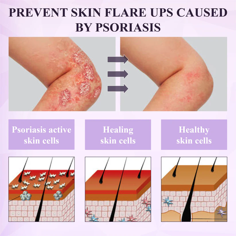 Fivfivgo® Purple Corn Multi-Condition Skin Spray
