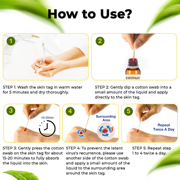 Fivfivgo® Bacteriostatic Black Cumin Skin Tag Remover 43 8 bf5a702a 139c 4111 aa99 2646dfb162ed