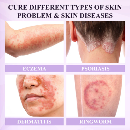 Fivfivgo® Purple Corn Multi-Condition Skin Spray
